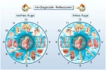 Bild: Irisdiagnose